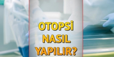 otopsi-nasil-yapilir-kac-saat-surer-otopsi-nedir-ne-demek-rojin-olayi-ile-gundemde-JmDwkViq.jpg